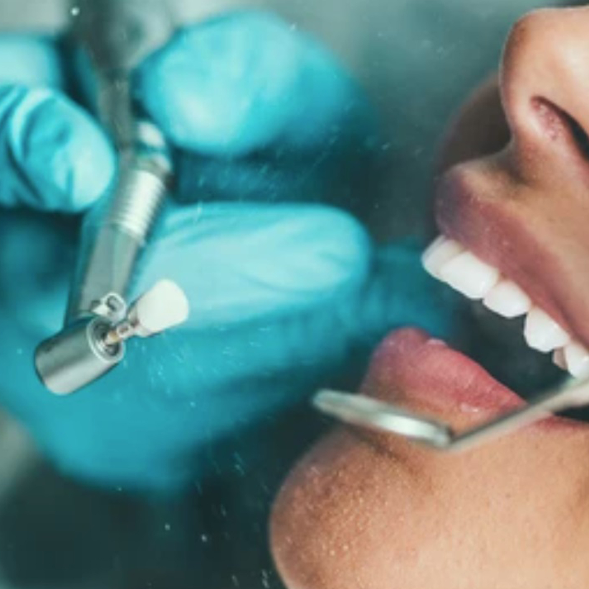 Default Category International/Dental Practice/POLISHING SYSTEMS